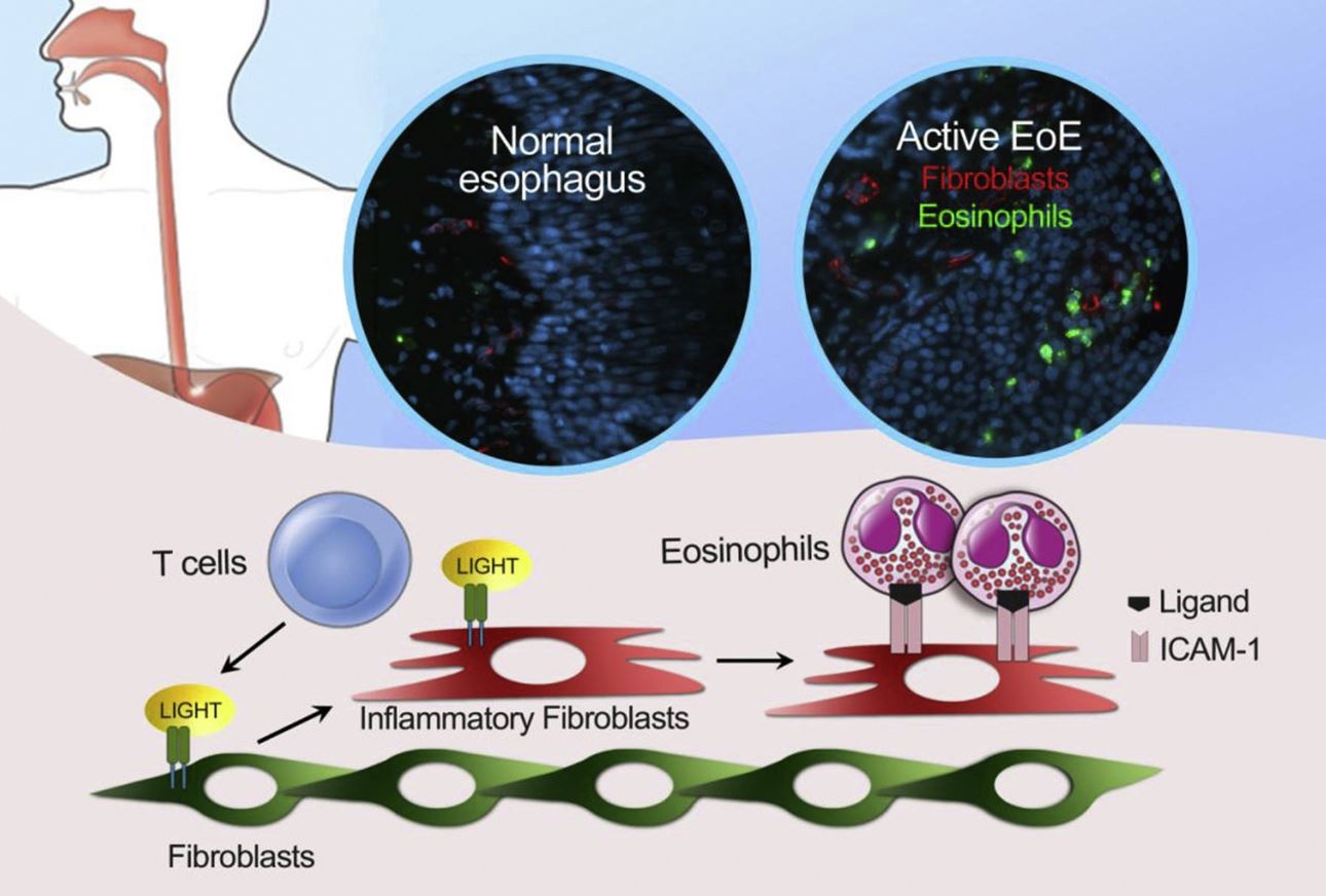 Light Graphical Abstract